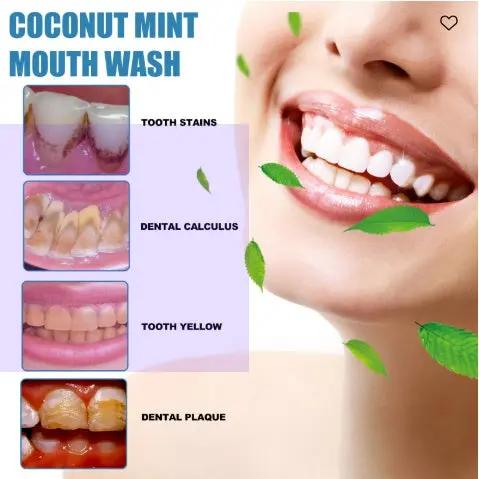 Oralhoe Coconut Mint Mouth Wash – Teeth Whitening & Fresh Breath Solution for Yellow Teeth (250ml) - AllvueCo