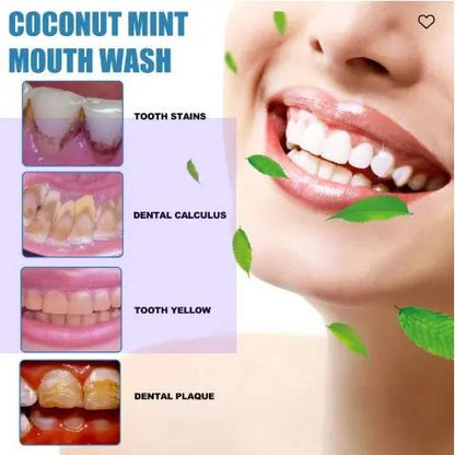 Oralhoe Coconut Mint Mouth Wash – Teeth Whitening & Fresh Breath Solution for Yellow Teeth (250ml) - AllvueCo