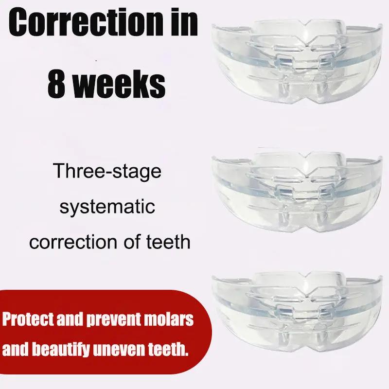 Invisible Braces Orthodontic Braces My Store