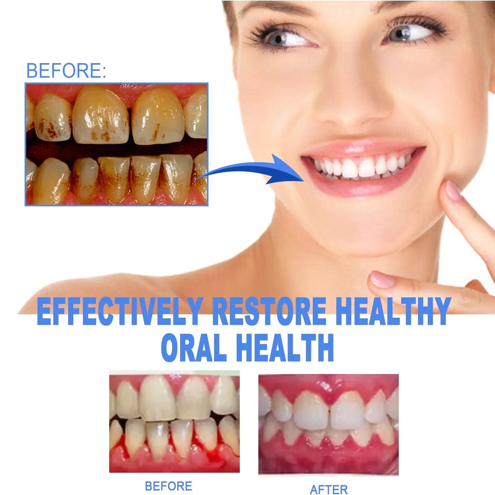 Tooth Repair Gel – Gum Care & Tartar Removal Oral Treatment - AllvueCo
