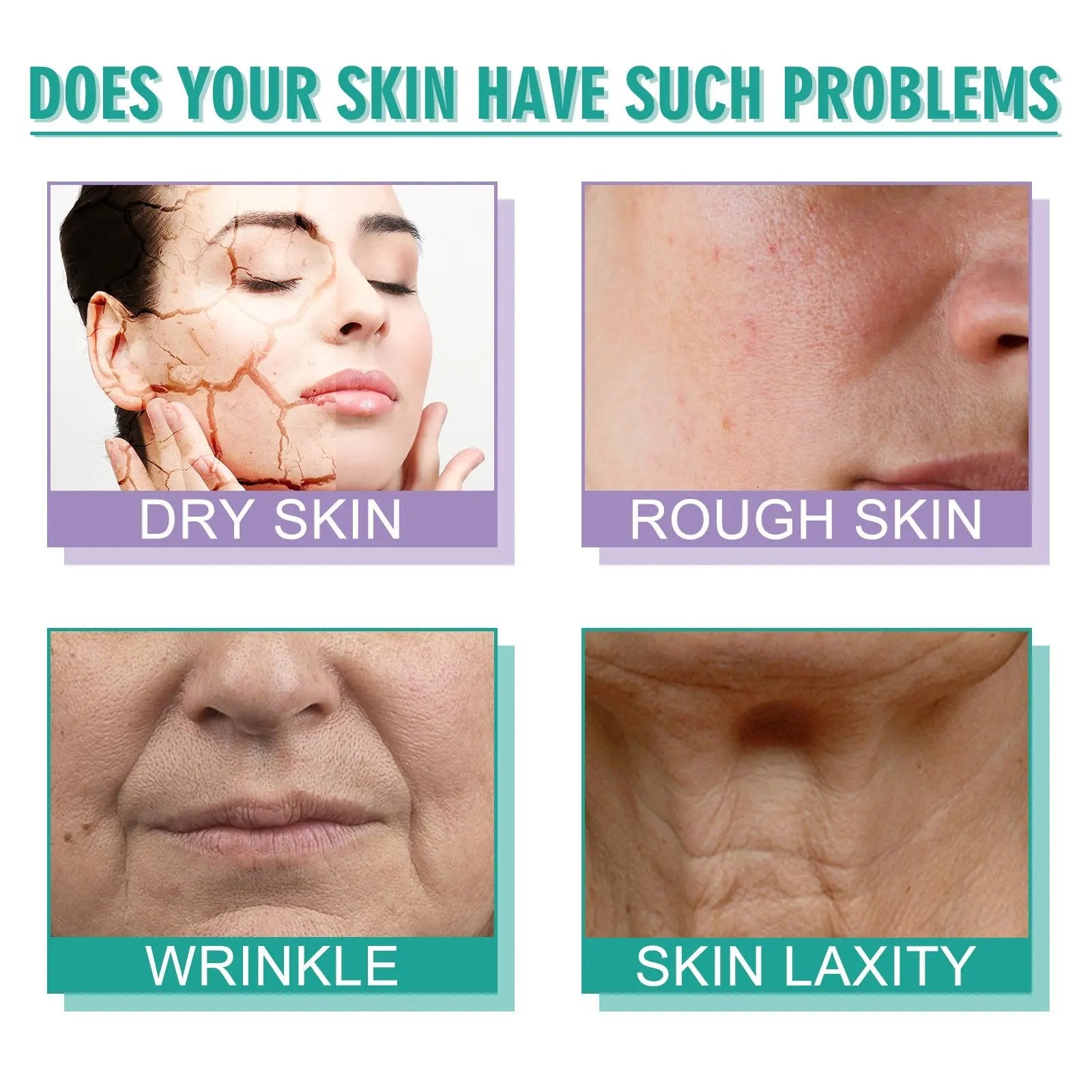 Hoygi Moisturizing Skin Care Cream – Lighten Pigmentation & Reduce Fine Lines (50ml) - AllvueCo