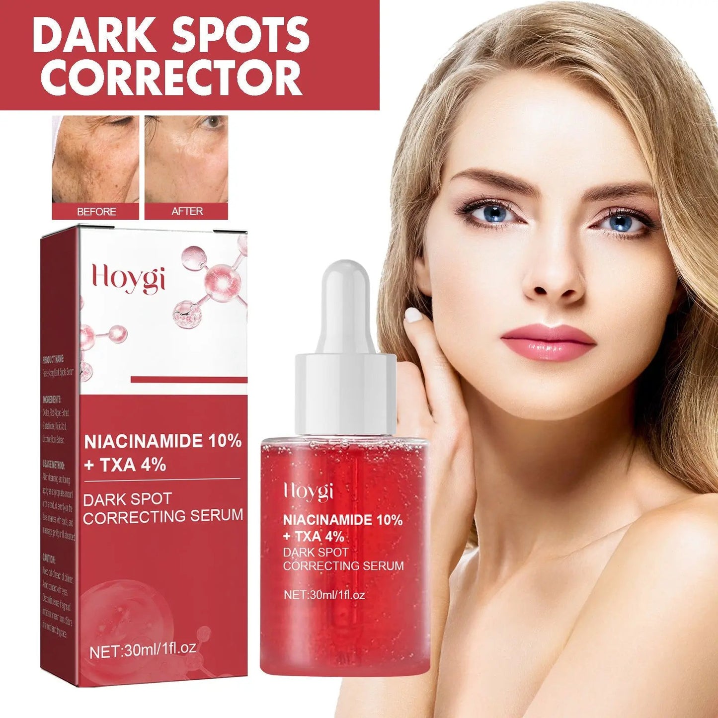 Hoygi Black Spot Repair Essence – Dark Spot Correcting & Skin Brightening Serum for Even Tone (30ml) My Store
