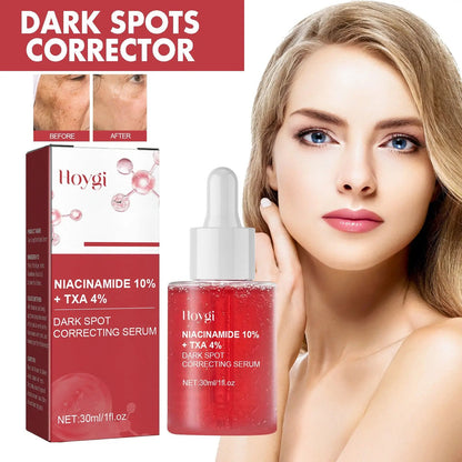 Hoygi Black Spot Repair Essence – Dark Spot Correcting & Skin Brightening Serum for Even Tone (30ml) My Store