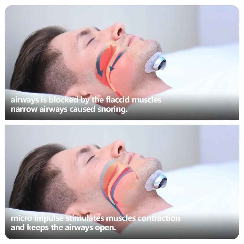 Smart Anti Snoring Device - Electronic Muscle Stimulator