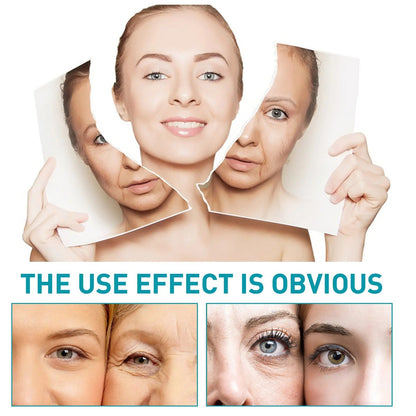 Eelhoe Hydroconus Peptide Anti-Wrinkle Serum – Skin Repair & Firming Facial Serum (30ml) - AllvueCo