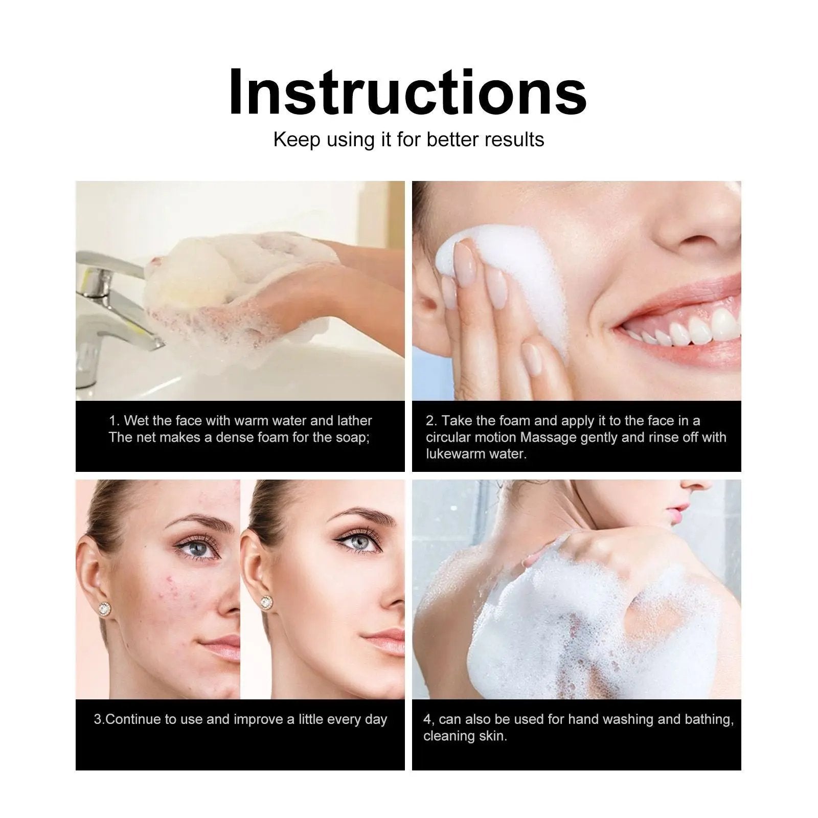 Jaysuing Acne Removing Mite Skin Soap – Deep Cleansing Natural Face & Body Bar for Acne, Blackheads & Oily Skin (80g) My Store