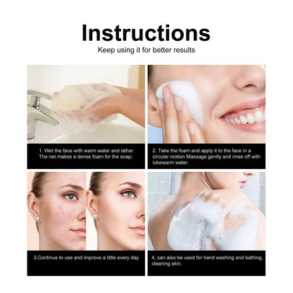 Jaysuing Acne Removing Mite Skin Soap – Deep Cleansing Natural Face & Body Bar for Acne, Blackheads & Oily Skin (80g) My Store