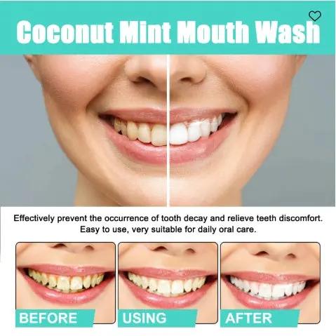 Oralhoe Coconut Mint Mouth Wash – Teeth Whitening & Fresh Breath Solution for Yellow Teeth (250ml) - AllvueCo