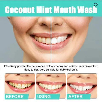Oralhoe Coconut Mint Mouth Wash – Teeth Whitening & Fresh Breath Solution for Yellow Teeth (250ml) - AllvueCo